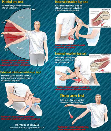 shoulder test for rotator cuff